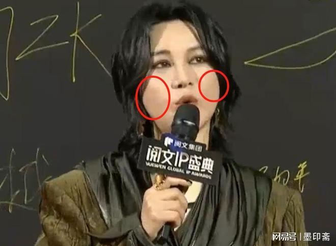 显、眼袋黝黑的殷桃治好了我的容貌焦虑AG真人平台新加坡这一晚：法令纹明(图20)